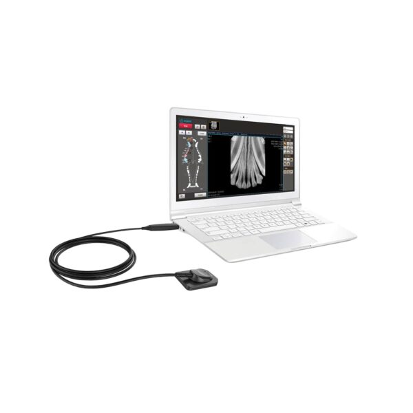 EZ DR Sensor for Dental X-Ray