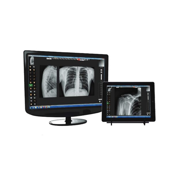 TigerView PACS Software