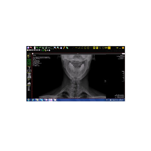 Viztek Opal Chiro DR