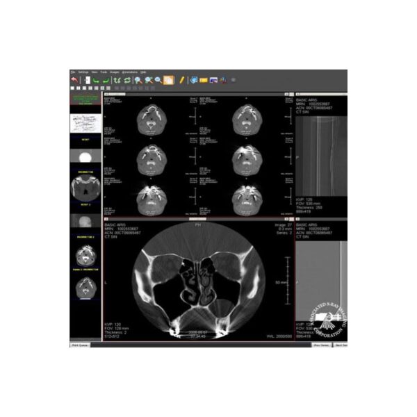 Viztek Opal-ORTHO PACS